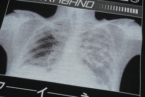 X-ray t-shirt bones print top grunge gothic tee in black